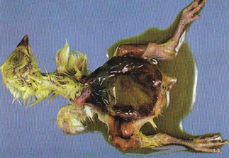 عفونت کیسه زرده