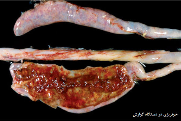 کوکسیدیوز